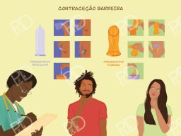 kit-album-pedagogico-pdfactor-prancha-10-metodos-barreira-800x566